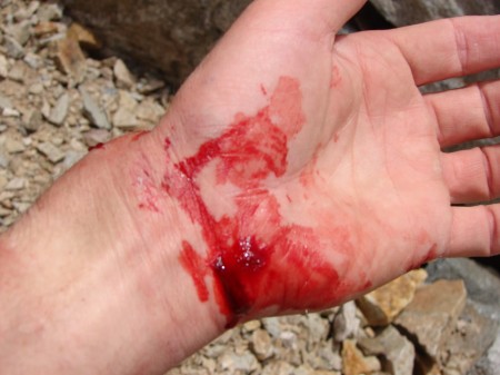 WristPhoto.jpg
